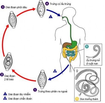 Chu K C A Giun A Ascaris Lumbricoides