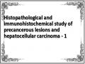 Histopathological and immunohistochemical study of precancerous lesions and hepatocellular carcinoma - 1