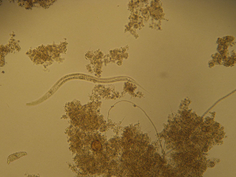 Hình 2 6 Giun tròn sống tự do free – living nematode Hình 2 7 Trùng bánh xe rotifer 4