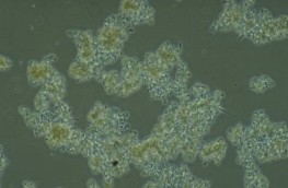 Hình 2 9 Bùn hoạt tính kết bông tốt b Cơ chế của việc tạo bông Cơ chế của 7