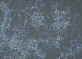 Hình 2 11 Bùn tạo khối do vi khuẩn dạng sợi Bảng 2 7 Các loài vi khuẩn dạng 1