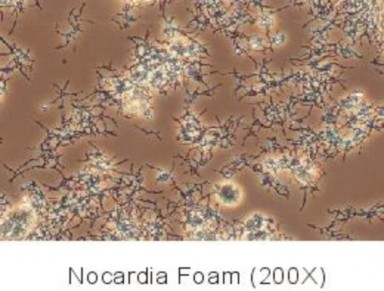 Hình 2 12 Bùn dạng bọt váng Nocardia Hiện tượng tạo bọt gây ra bởi vi khuẩn 2