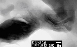 Hình 2 10 Tỷ lệ 1 claynano theo khối lượng epoxy Tỷ lệ 2 như hình 2 11 cho 10