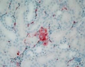 Kháng nguyên ở não nhuộm IHC Kháng nguyên ở phổi nhuộm IHC Kháng nguyên ở 1