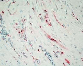 Kháng nguyên ở não nhuộm IHC Kháng nguyên ở phổi nhuộm IHC Kháng nguyên ở 2