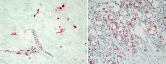 Kháng nguyên ở não nhuộm IHC Kháng nguyên ở phổi nhuộm IHC Kháng nguyên ở 4