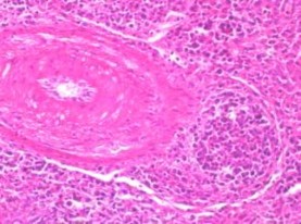 Kết quả xét nghiệm vi thể khá tương đồng với kết quả xét nghiệm RRT PCR 1