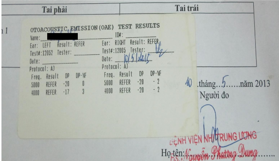 Hình 3 Kết quả đo OAE âm tính ảnh minh họa Phân biệt giữa nghe kém tiếp 1