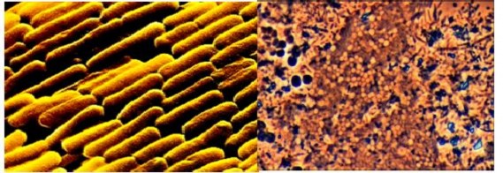 C d e f Hình 2 6 Một số loại vi khuẩn trong nước thải a Peseudomonas 2