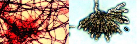 E f Hình 2 6 Một số loại vi khuẩn trong nước thải a Peseudomonas 3