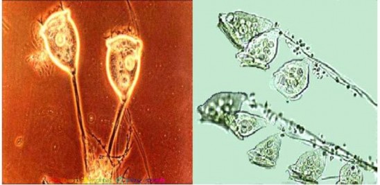 B Peritrichia chủng có mao c Carchesium Polypium d Vorticella Convallaria e Holotrichate 6
