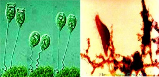D Vorticella Convallaria e Holotrichate chủng có mao Hình 2 8 Một số nguyên sinh 7