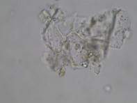 Hình 3 4 Đặc điểm bột phần trên mặt đất của loài Piper thomsonii C DC 3