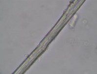 Hình 3 4 Đặc điểm bột phần trên mặt đất của loài Piper thomsonii C DC 7