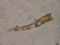 Đặc điểm bột phần trên mặt đất của loài Piper hymenophyllum Miq được thấy 1