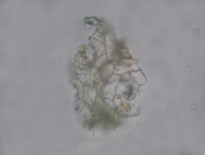 Đặc điểm bột phần trên mặt đất của loài Piper hymenophyllum Miq được thấy 3