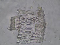 Đặc điểm bột phần trên mặt đất của loài Piper hymenophyllum Miq được thấy 6