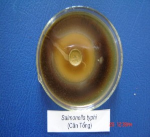 Hình 2 1 Ảnh được gây ức chế xung quanh giếng thạch Chúng tôi còn tiến hành 1