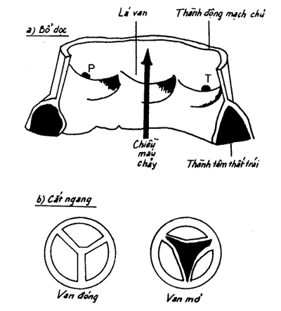 Hình 1 4 Van động mạch chủ tức là van tổ chim bên trái P và T là hai lỗ 4