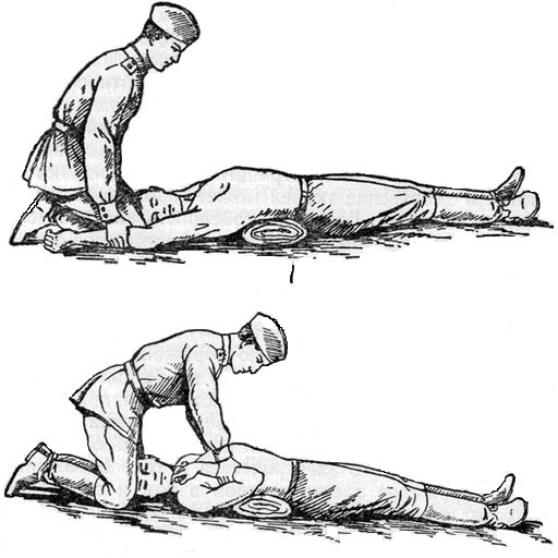 Nhược điểm Dịch vị dễ chạy lên cuống họng làm cản trở hô hấp Ưu 2