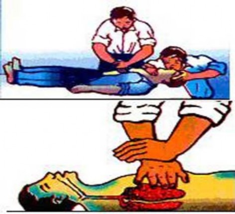 Hình 10 2 Làm hô hấp nhân tạo Xoa bóp tim ngoài lồng ngực Nếu có hai người 2