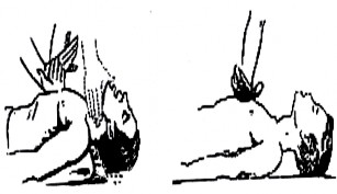 Hình 2 9 Bài tập 2 Nêu những trình tự cứu người khi bị điện giật Xây 1