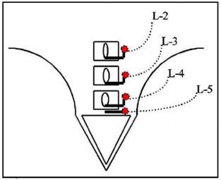 Hình 2 16 Vị trí đâm kim ở các cơ cạnh sống mô hình 66 Hình 2 17 Vị trí 1