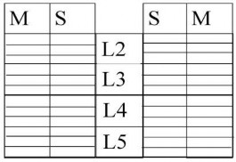 Bên trái … Bên phải… S Vị trí đâm kim chếch 45 độ sâu khoảng trên 4 cm so 2