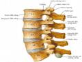 Nghiên cứu đặc điểm lâm sàng, chẩn đoán điện và cộng hưởng từ ở bệnh nhân thoát vị đĩa đệm cột sống thắt lưng, cùng - 2