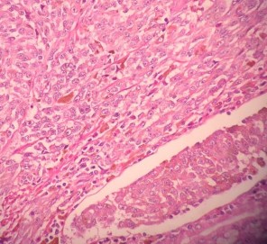 HE x 400 U giàu nhân chia bài tương giàu hạt sắc tố CHE x 400 U xâm nhập mạch 4