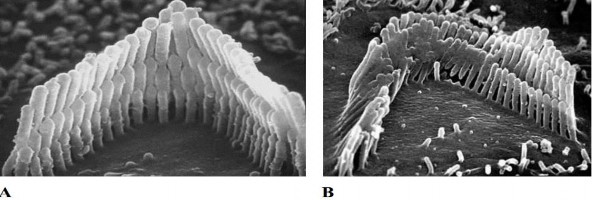 Hình 1 2 A Các tế bào lông ngoài bình thường B Các tế bào lông ngoài bị 1