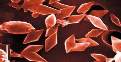 Hình 1 2 Tinh thể của vi khuẩn Bacillus thuringiensis 21 1 1 3 Đặc điểm sinh hoá 2