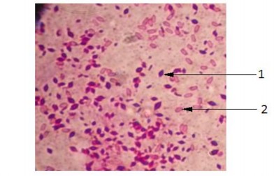 Hình 3 2 Hình dạng bào tử và tinh thể của Bt phóng đại 1000 lần dưới kính 1