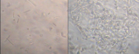 A B Hình 3 3 Sản phẩm ngưng kết huyết thanh của chủng TN 6 12 phân lập với typ 2