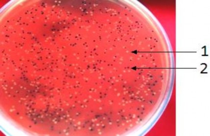 Hình 3 7 Khuẩn lạc xanh trắng xuất hiện trên môi trường LBA sau khi nuôi cấy 7