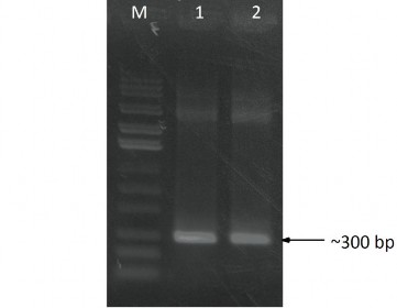 Hình 3 10 Điện di đồ sản phẩm PCR gene cry1C từ các DNA plasmid tái tổ hợp 3