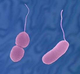 Hình 1 1 Vi khuẩn V parahaemolyticus Hình 1 2 Vi khuẩn V vulnificus Buller 2004 1