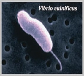 Hình 1 1 Vi khuẩn V parahaemolyticus Hình 1 2 Vi khuẩn V vulnificus Buller 2004 2