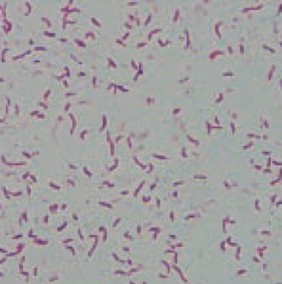 Hình 1 7 Nhuộm gram vi khuẩn V Vulnificus Buller 2004 Hình 1 8 Phản ứng Indol trên 7
