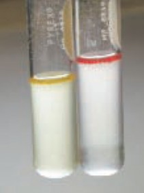 Hình 1 7 Nhuộm gram vi khuẩn V Vulnificus Buller 2004 Hình 1 8 Phản ứng Indol trên 8