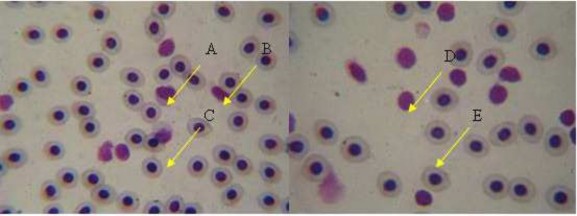 Hình 4 2 Bạch cầu đơn nhân A tiểu cầu B bạch cầu trung tính C tế bào 1