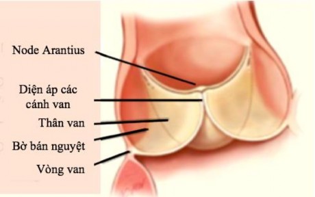 Schubert 2016 27 Hình 1 3 Thiết đồ cắt dọc qua van động mạch chủ Nguồn 3