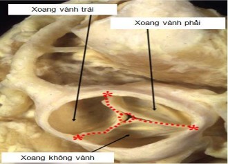 Hình 1 5 Thiết đồ cắt ngang ĐMC van ĐMC nhìn từ trên xuống dưới Nguồn 5