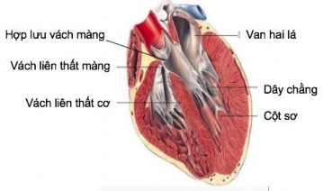 Hình 1 11 Liên quan của gốc động mạch chủ với vách liên thất 26 Thông liên 3