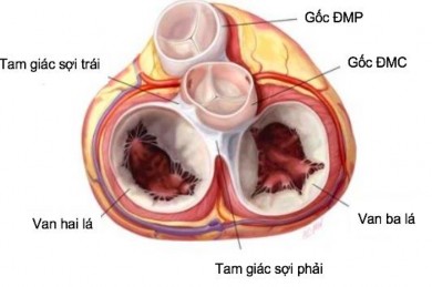 Hình 1 12 Thiết đồ cắt ngang qua đáy tim Liên quan của gốc động mạch chủ 4