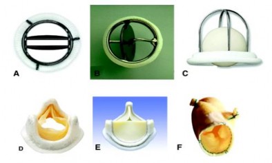 Hình 1 16 Các loại van tim nhân tạo A Van hai cánh B Van đĩa C Van bi D E Van 3