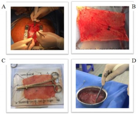 Hình 2 8 Quy trình lấy và xử lý màng ngoài tim A Phẫu tích màng ngoài tim bằng 8