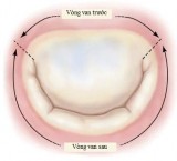 Hình 1 3 Cấu trúc của lá van và vòng van hai lá Nguồn Carpentier A 2010 24 Trong 2