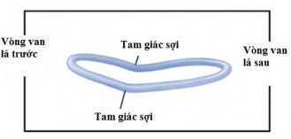 Hình 1 7 Hình dạng yên ngựa của vòng van hai lá Nguồn Sarah A 2017 88 Hình 3