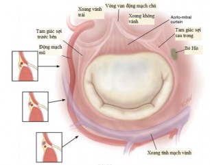 Hình 1 8 Các cấu trúc quan trọng xung quanh van hai lá Nguồn Sarah A 2017 88 4